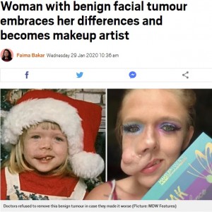 【海外発！Breaking News】顔に腫瘍がある27歳女性、大好きなメイクで動画配信「本当の美しさとは…」（米）