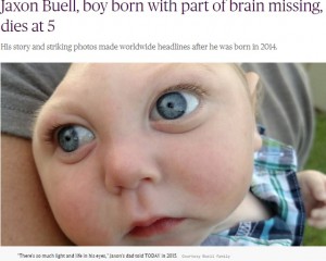 【海外発！Breaking News】脳が20％で産まれた“奇跡の子”5歳で天国へ　父「医師に『できない』と言われたことを克服し続けた」（米）