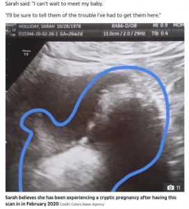 今年2月の超音波検査の画像（画像は『The Sun　2020年3月30日付「BABY HOPE Woman, 40, claims she’s been pregnant for three years after suffering nine miscarriages」（Credit: Caters News Agency）』のスクリーンショット）