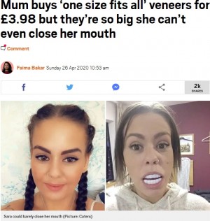 【海外発！Breaking News】約500円でネット購入した人工歯（ベニア）に大爆笑「大きすぎて口が閉まらない」（英）