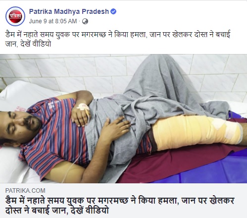 ワニに太腿の一部を噛み切られ病院で手当てを受けたアミットさん（画像は『Patrika Madhya Pradesh　2020年6月9日付Facebook「डैम में नहाते समय युवक पर मगरमच्छ ने किया हमला, जान पर खेलकर दोस्त ने बचाई जान, देखें वीडियो」』のスクリーンショット）