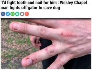 ワニを殴った後のトレントさんの手（画像は『WFLA　2020年6月10日付「‘I’d fight tooth and nail for him’: Wesley Chapel man fights off gator to save dog」』のスクリーンショット）