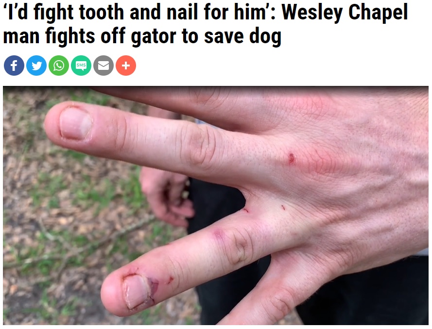ワニを殴った後のトレントさんの手（画像は『WFLA　2020年6月10日付「‘I’d fight tooth and nail for him’: Wesley Chapel man fights off gator to save dog」』のスクリーンショット）