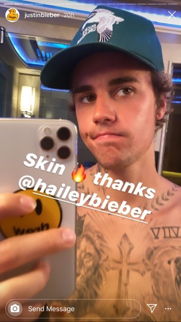 肌荒れがかなり改善されたジャスティン・ビーバー（画像は『Justin Bieber　2020年7月23日付Instagram』のスクリーンショット）