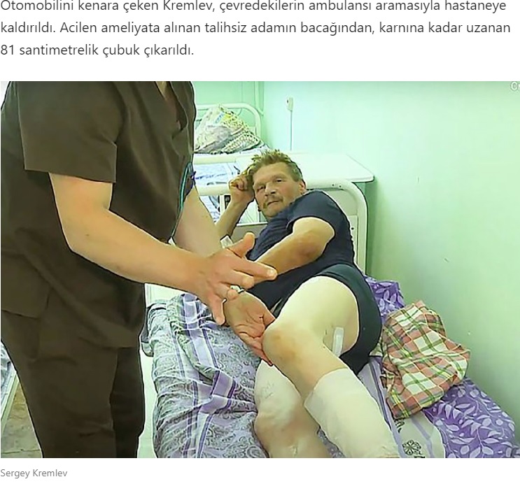 鉄の棒を抜く手術をした後の男性（画像は『Sözcü Gazetesi　2020年7月21日付「Mucize kurtuluş! Arabadayken saplandı… Doktorlar bile inanamadı」』のスクリーンショット）