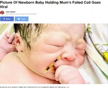 【海外発！Breaking News】避妊に失敗してできた赤ちゃん　子宮内避妊器具（IUD）を握った記念写真が大反響（ベトナム）