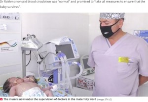 赤ちゃんの様子を見守る医師（画像は『Daily Star　2020年7月1日付「‘Two-headed’ baby born to baffled doctors and placed in intensive care」（Image: STV.UZ）』のスクリーンショット）