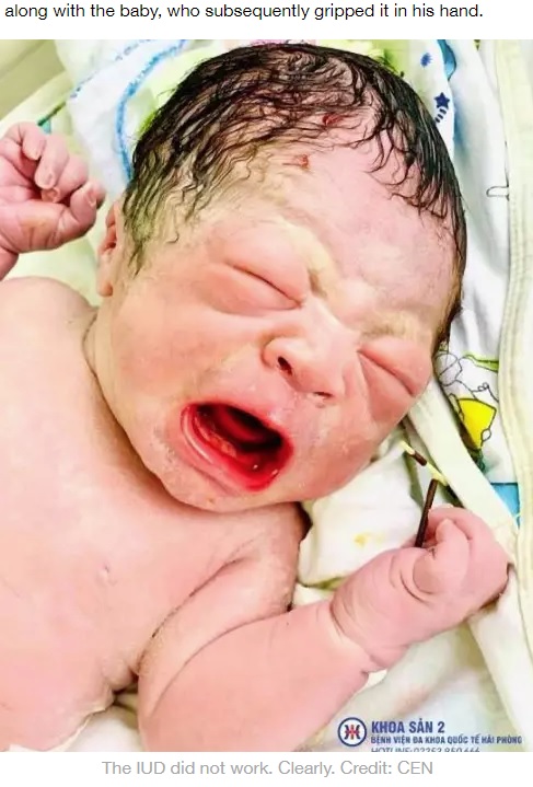 IUDを持ったまま泣く男児（画像は『LADbible　2020年7月6日付「Picture Of Newborn Baby Holding Mum’s Failed Coil Goes Viral」（Credit: CEN）』のスクリーンショット）