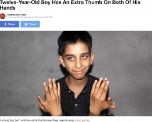 【海外発！Breaking News】12本の手指を持つ少年、将来の夢は「医者になって同じ疾患を持つ人を治療したい」（印）