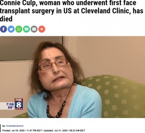 【海外発！Breaking News】米国初の顔面移植手術を受けた女性が死去　「心が美しい人だった」と医師＜動画あり＞