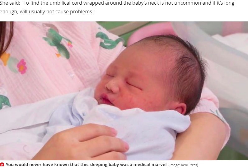 へその緒が首に6回も巻きつくも元気に産まれた赤ちゃん（画像は『Mirror　2020年8月6日付「Medical miracle as baby born with umbilical cord wrapped six times around neck survives」（Image: Real Press）』のスクリーンショット）