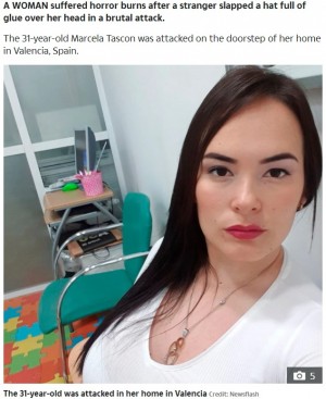 【海外発！Breaking News】浮気の報復か　見知らぬ男に接着剤入りの帽子を被せられた女性、頭皮を火傷（スペイン）