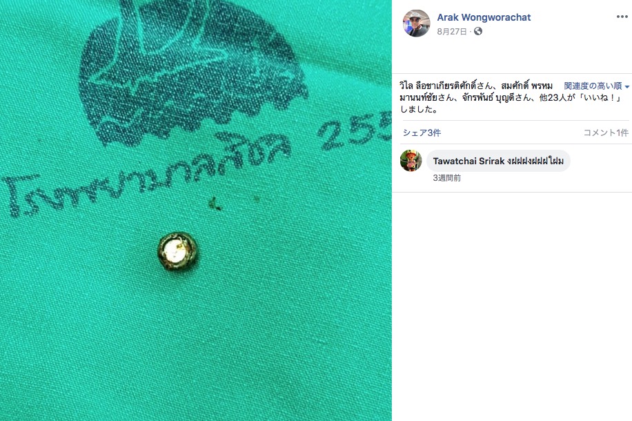 女児の鼻の奥から摘出された電池（画像は『Arak Wongworachat　2020年8月27日付Facebook「＃เด็ก3ขวบเอาแบตเตอรี่นาฬิกาใช้แล้วใส่จมูก」』のスクリーンショット）