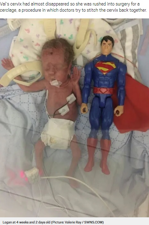 生後4週と2日のローガン君（画像は『Metro　2020年10月23日付「Premature baby born the size of a Superman toy miraculously survives and thrives」（Picture: Valerie Ray / SWNS.COM）』のスクリーンショット）