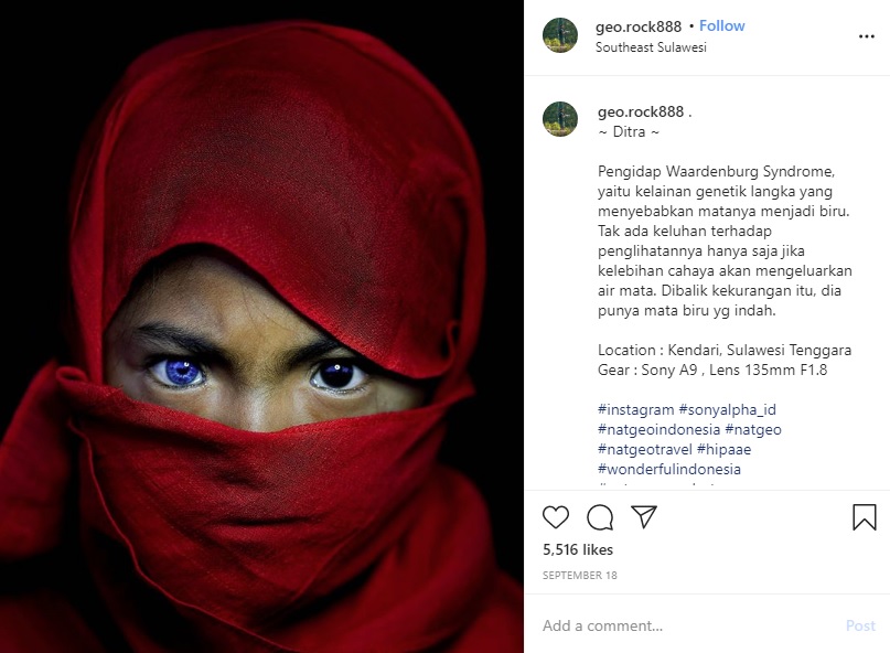 左右の瞳の色が違う少女（画像は『Korchnoi Pasaribu　2020年9月18日付Instagram「～ Ditra ～」』のスクリーンショット）