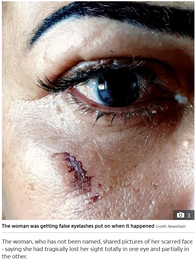 「目に痛みを感じた」と主張する女性（画像は『The Sun　2020年10月3日付「BLINDED BY LASHES Woman left blind and scarred after glue from false eyelashes fell into her eye at beauty salon」（Credit: Newsflash）』のスクリーンショット）
