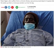 【海外発！Breaking News】遺体安置室に運ばれた男性、防腐処理で脚を傷つけられ息を吹き返す（ケニア）