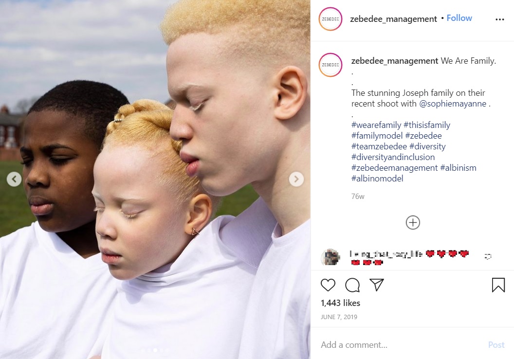モデルとして活躍するアルビノの兄妹と次男（画像は『Zebedee Management　2019年6月7日付Instagram「We Are Family.」』のスクリーンショット）
