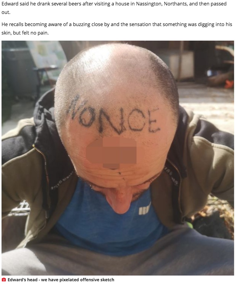 「性犯罪者」と頭に刺青を彫られた男性（画像は『Mirror　2020年11月28日付「Worker woke to find word ‘nonce’ tattooed on forehead as two arrested for GBH」』のスクリーンショット）