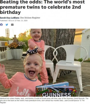 【海外発！Breaking News】予定日より4か月半早く誕生し「ギネス記録」を持つ双子、1ドル札ほどの身長が80センチになって2歳に（米）