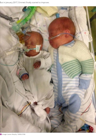 一卵性双子ながら大きさが全く違った2人（画像は『Birmingham Mail　2020年12月2日付「Twins born with a rare condition which makes one DOUBLE the size of the other」（Image: Lauren Murphy / SWNS.COM）』のスクリーンショット）