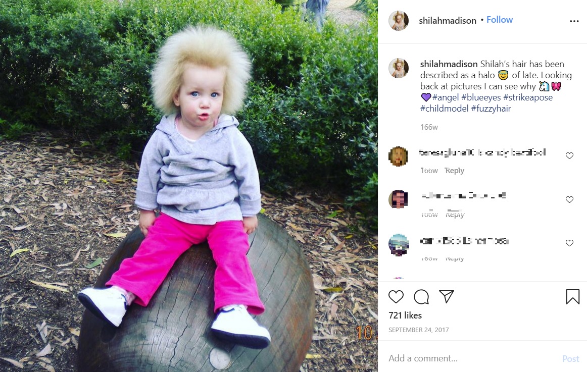 見事に逆立つ髪（画像は『Shilah Madison Calvert-Yin　2017年9月24日付Instagram「Shilah’s hair has been described as a halo」』のスクリーンショット）