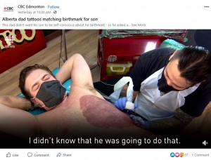 胸に息子と同じ母斑のタトゥーを入れてもらうデレックさん（画像は『CBC Edmonton　2020年12月12日付Facebook「Alberta dad tattoos matching birthmark for son」』のスクリーンショット）