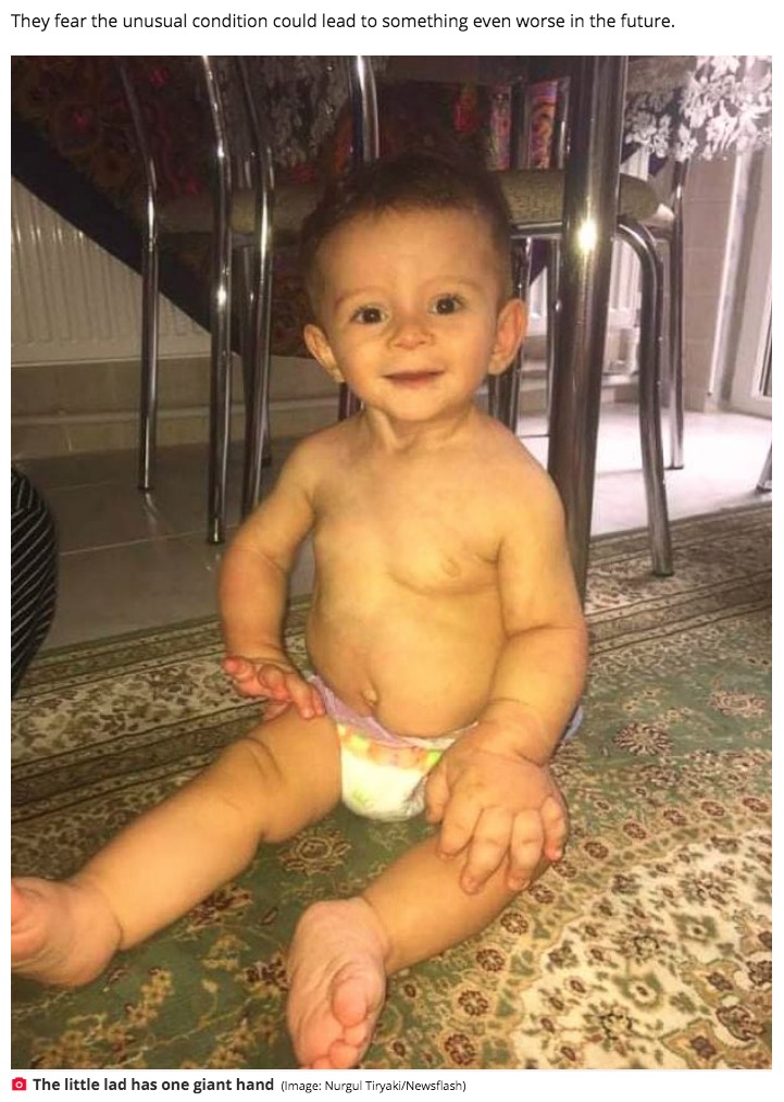 笑顔を見せるマフムト君（画像は『Daily Star　2021年1月7日付「Tot, 18-months-old, has ‘hand and foot of a 10-year-old’ due to ultra-rare condition」（Image: Nurgul Tiryaki/Newsflash）』のスクリーンショット）