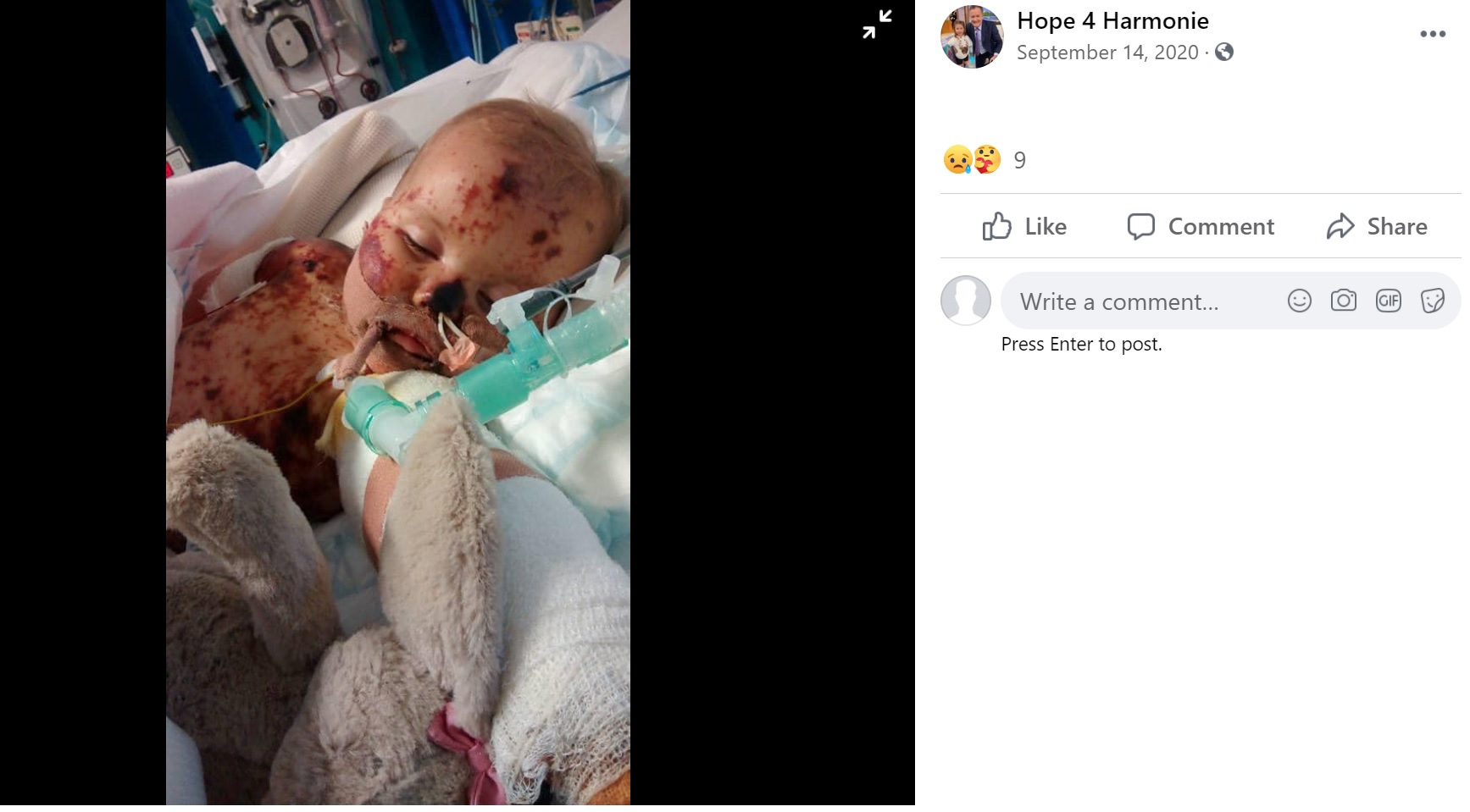 生後10か月で入院したハーモニーちゃん（画像は『Hope 4 Harmonie　2020年9月14日付Facebook』のスクリーンショット）