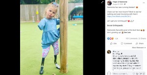 【海外発！Breaking News】生後10か月で四肢切断した7歳女児「夢はパラリンピック選手」（英）