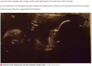 【海外発！Breaking News】「ゴリラ…いやトランプ大統領！」エコー写真に妊婦が愕然（英）