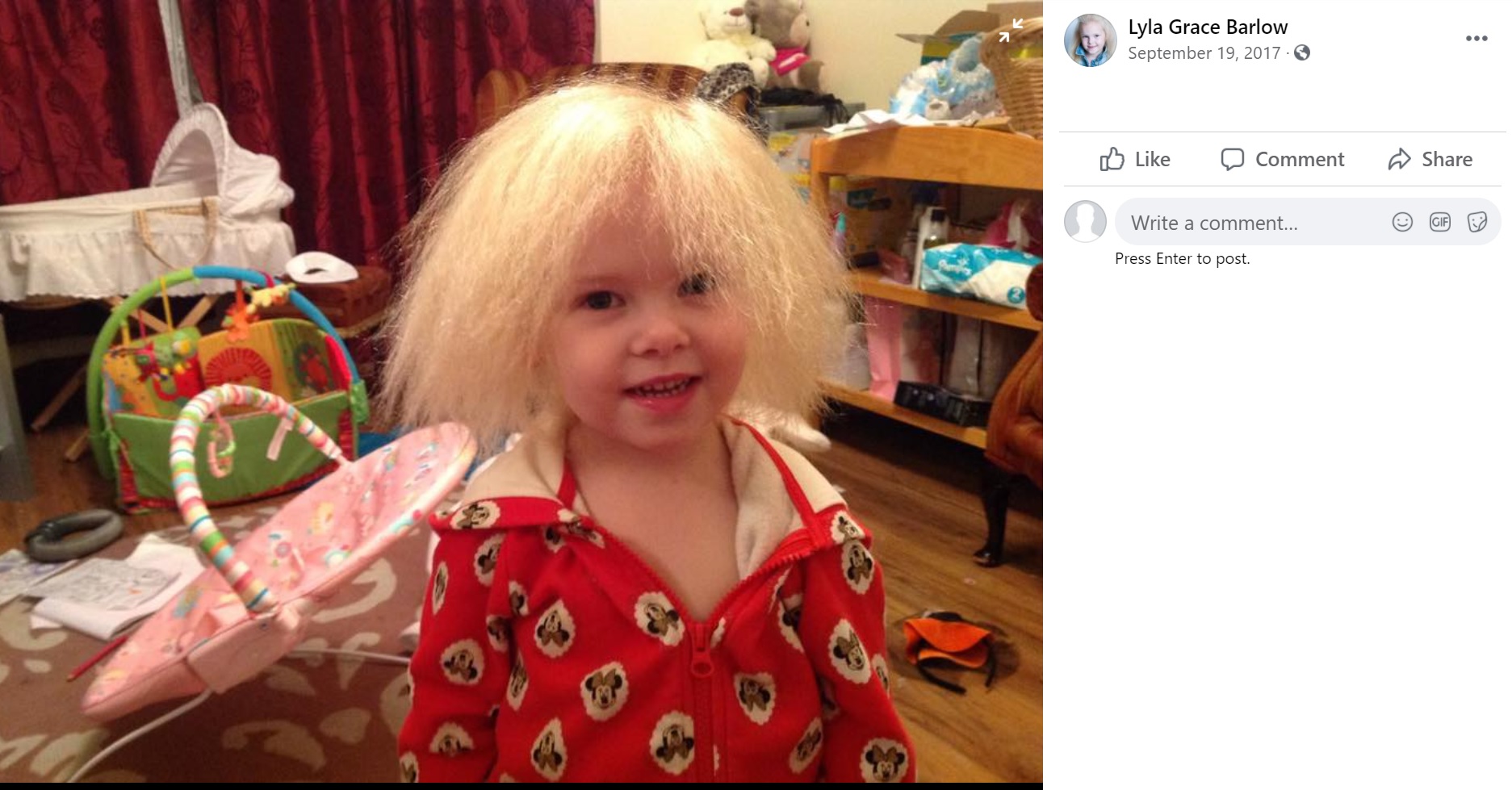「櫛でとかせない頭髪症候群」の女児（画像は『Lyla Grace Barlow﻿　2017年9月19日付Facebook』のスクリーンショット）
