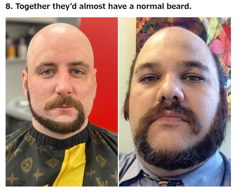 右巻きにするか、左巻きにするかが悩みどころ…？（画像は『Pleated Jeans　2021年1月14日付「“Monkey Tail” Beards Are The Latest Male Facial Hair Trend That Needs To Stop （22 Pics）」』のスクリーンショット）