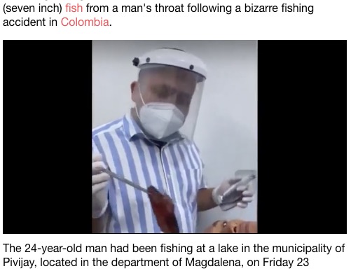 男性の喉から魚を取り除いた医師（画像は『LADbible 2021年1月31日付「Doctors In Colombia Remove 18cm Fish From Man's Throat」』のスクリーンショット）