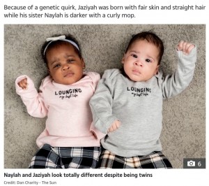 【海外発！Breaking News】肌の色も髪質も全く異なる4か月の双子姉妹　でも目の色と顔はそっくり！（英）
