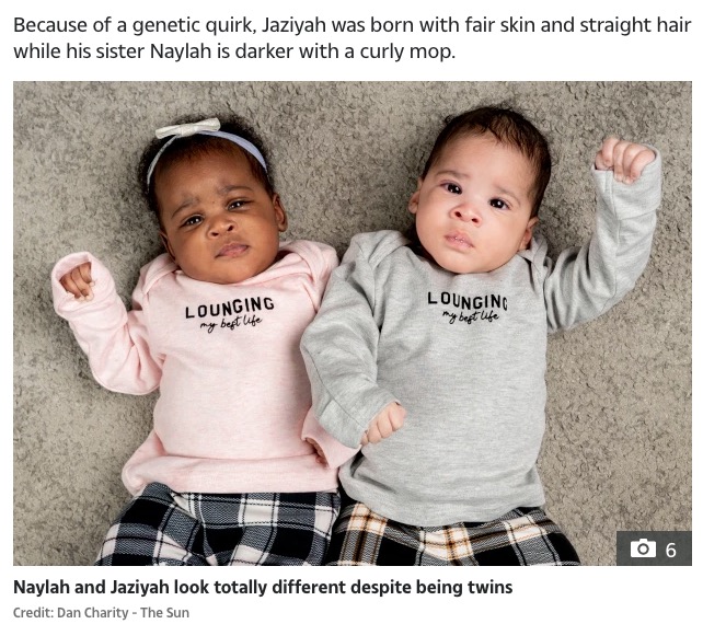 明らかに見分けがつく双子の姉妹（画像は『The Sun　2021年1月30日付「TWO OF A KIND Miracle twins born with different coloured skin thanks to one-in-a-million scientific quirk」（Credit: Dan Charity - The Sun）』のスクリーンショット）
