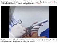 【海外発！Breaking News】釣りの最中に口にくわえた魚が喉の奥に潜り込み、窒息しかけた男性（コロンビア）＜動画あり＞