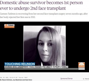 カルメンさんの顔のドナーとなったケイシー・ラブリエさん（画像は『TODAY　2021年2月28日付「Domestic abuse survivor becomes 1st person ever to undergo second face transplant」』のスクリーンショット）
