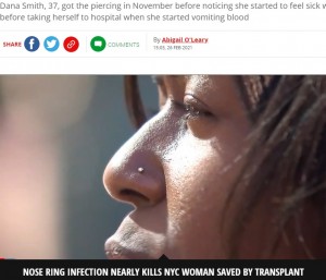【海外発！Breaking News】鼻ピアスからB型肝炎ウイルスに感染した女性、重症化し目覚めたら肝移植が終わっていた（米）