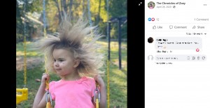 【海外発！Breaking News】ライオンのたてがみのような髪を持つ「櫛でとかせない頭髪症候群」の5歳女児（米）