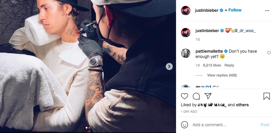 施術中の様子を公開したジャスティン（画像は『Justin Bieber　2021年3月28日付Instagram「＠_dr_woo_」』のスクリーンショット）