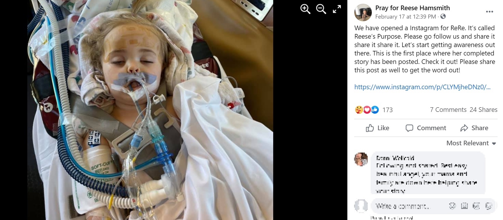 入院中のリースちゃん（画像は『Pray for Reese Hamsmith　2021年2月17日付Facebook「We have opened a Instagram for ReRe.」』のスクリーンショット）