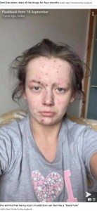 「薬物はあなたを愛さない」と語るデミさん（画像は『The Scottish Sun　2020年11月12日付「FRESH START Ex-heroin addict mum-of-two, 27, shares stunning before-and-after addiction photos」（Credit: Demi-Nicole Dunlop facebook）」』のスクリーンショット）
