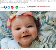 【海外発！Breaking News】「緑色の嘔吐物に気を付けて！」生後1週間で緊急手術を受けた女児の母が注意喚起（英）