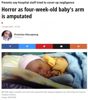 【海外発！Breaking News】点滴の種類を間違えた？　脱水症状で入院した新生児の腕が切断される事態に（南ア）
