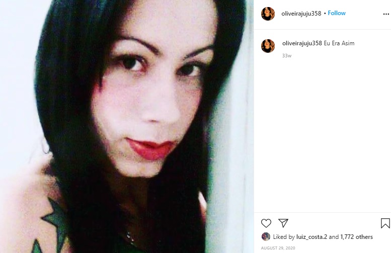 施術を受ける前の女性（画像は『Juju Oliveira　2020年8月29日付Instagram「Eu Era Asim」』のスクリーンショット）