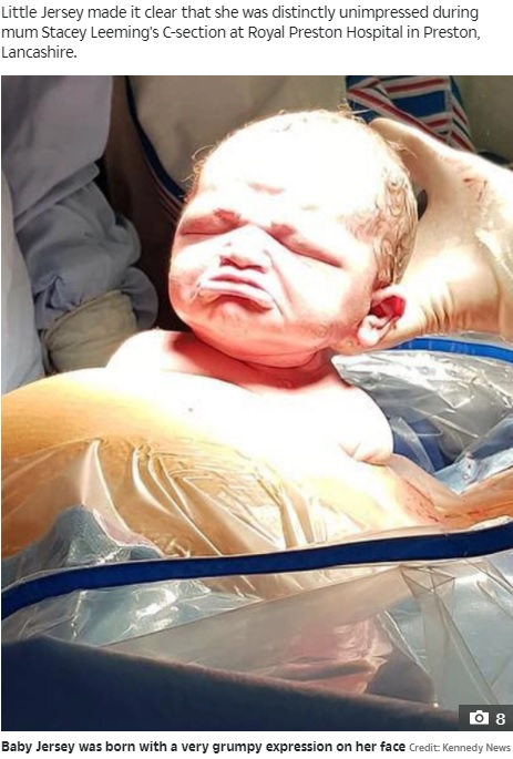 不機嫌顔で誕生したジャージーちゃん（画像は『The Sun　2021年3月19日付「LOOK WHO’S SULKING Newborn emerges into world for first time pulling grumpiest face possible - and mum says she’s still grumpy two years on」（Credit: Kennedy News）』のスクリーンショット）