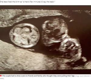 超音波検査で三つ子であることが判明（画像は『Mirror　2021年4月21日付「Couple welcome ‘200 million to one’ identical triplets who arrived 10 weeks early」（Image: Lauren Mountain / SWNS）』のスクリーンショット）