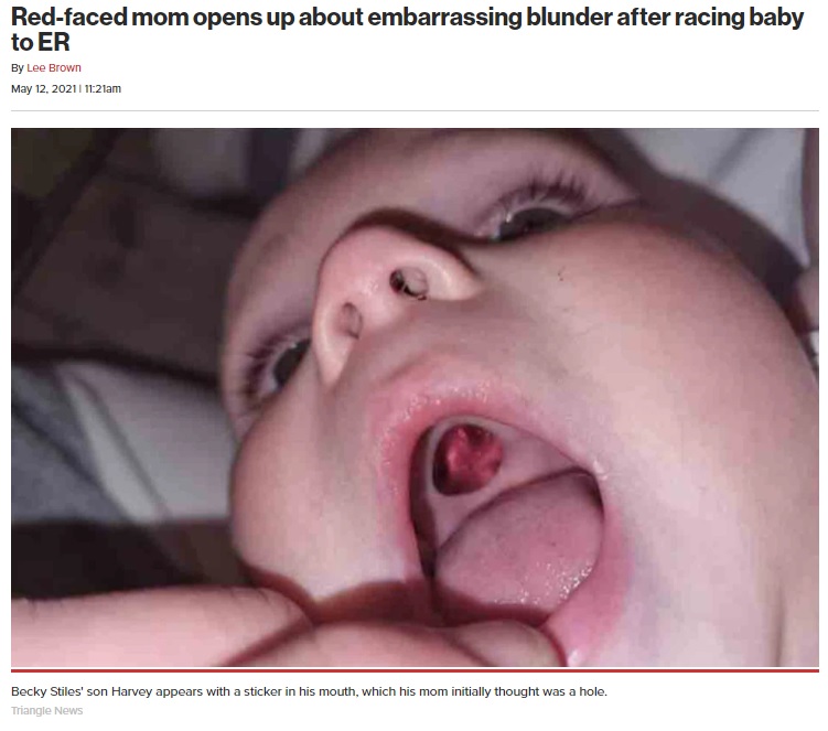 「穴」と言われても納得してしまうようなハーヴィー君の口（画像は『New York Post　2021年5月12日付「Red-faced mom opens up about embarrassing blunder after racing baby to ER」（Triangle News）』のスクリーンショット）