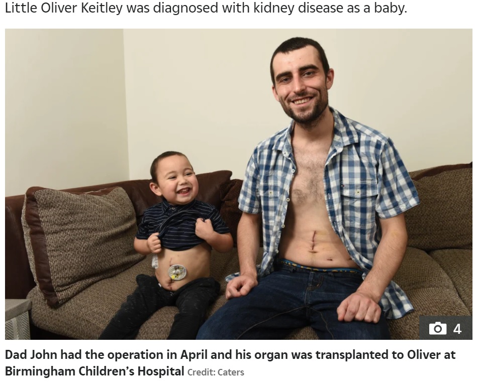 片方の腎臓を息子のオリバー君に移植したジョンさん（画像は『The Sun　2021年5月25日付「KID AROUND Dad becomes ‘real-life superhero’ by donating son, four, a kidney」（Credit: Caters）』のスクリーンショット）